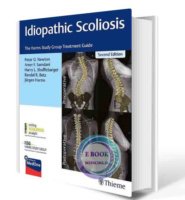 دانلود کتاب Idiopathic Scoliosis: The Harms Study Group Treatment Guide 2nd 2021 (ORIGINAL PDF)